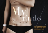 MY ENDO - A docufilm by Ellen Andries & Thomas Maddens / A Mad Production